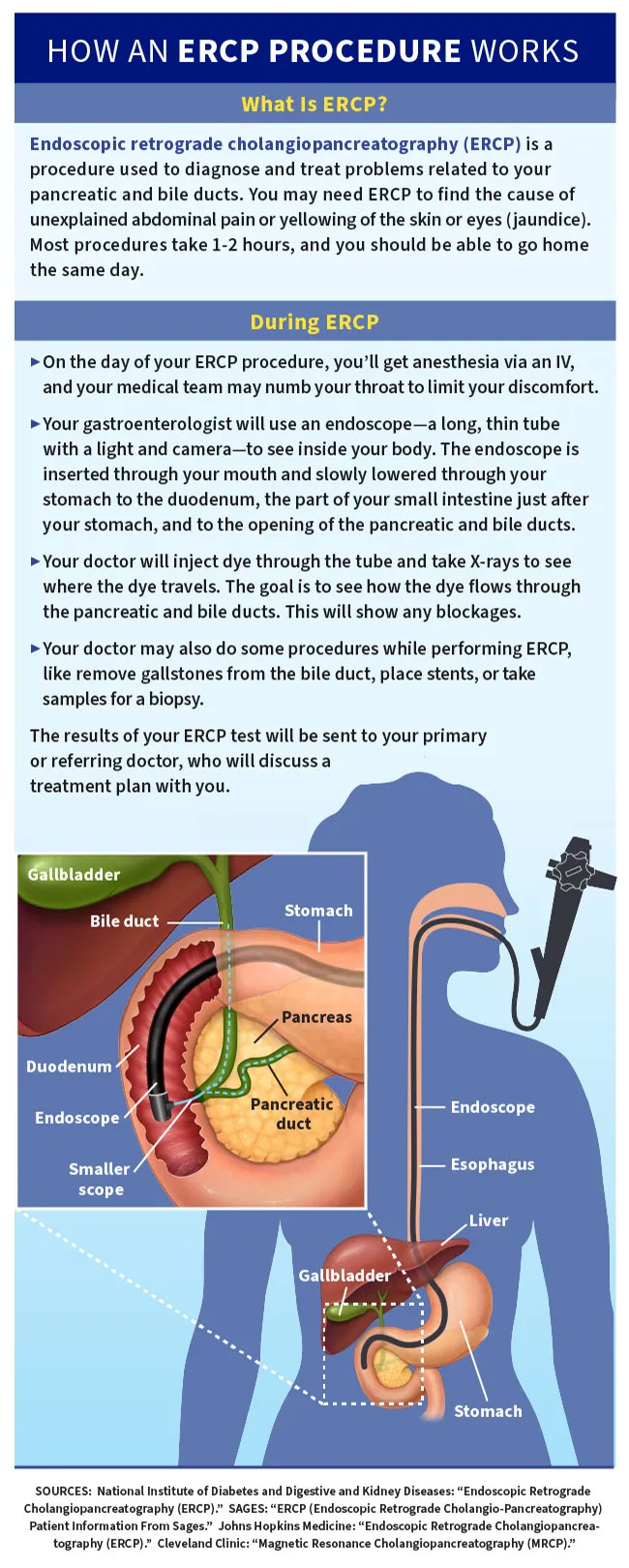 ERCP1.jpg