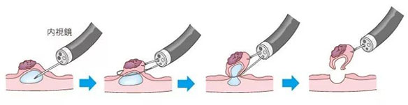 EMR-&-ESD2.jpg