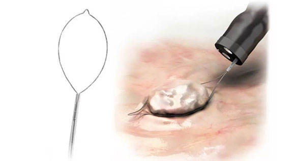 EMR-&-ESD8.jpg
