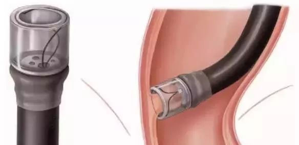 EMR-&-ESD9.jpg